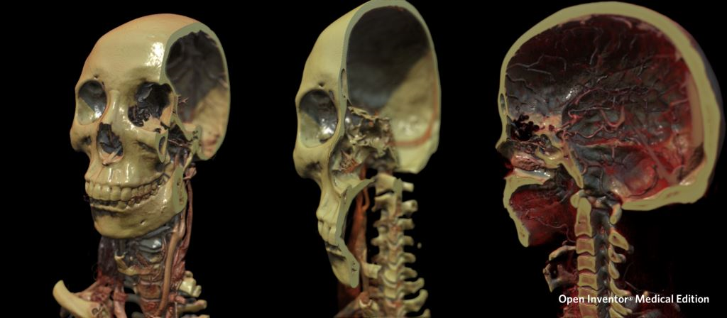 Physically Based Shading - Open Inventor Medical Edition (Skull)