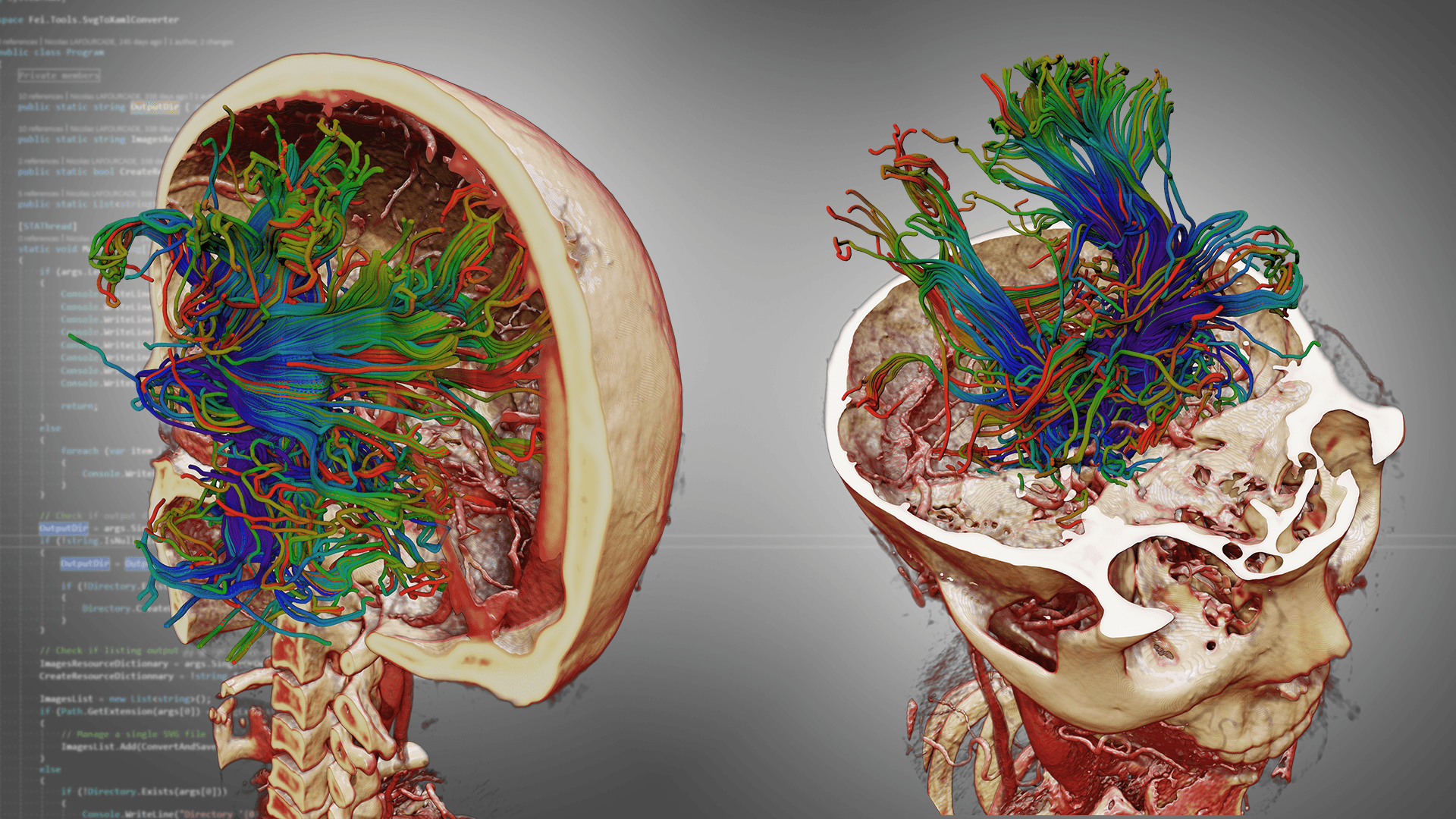 Skull-DTI_News-Illustration