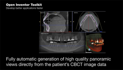 Automatic Dental Panoramic