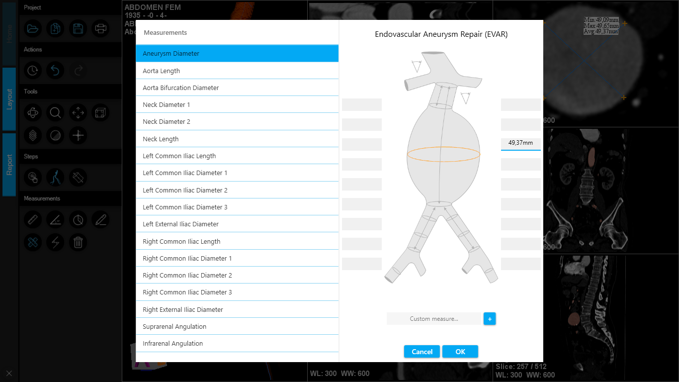 EVAR report planning with measurements integrated