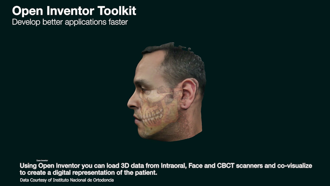 Need to visualize and interact with multi-modal 3D medical data sets for orthodontic and surgical planning?