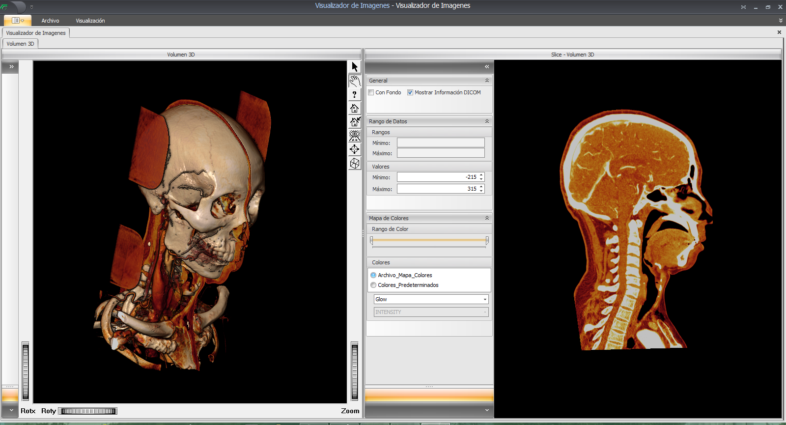 SYAC-PACS-OpenInventor-Medical-3D-Toolkit