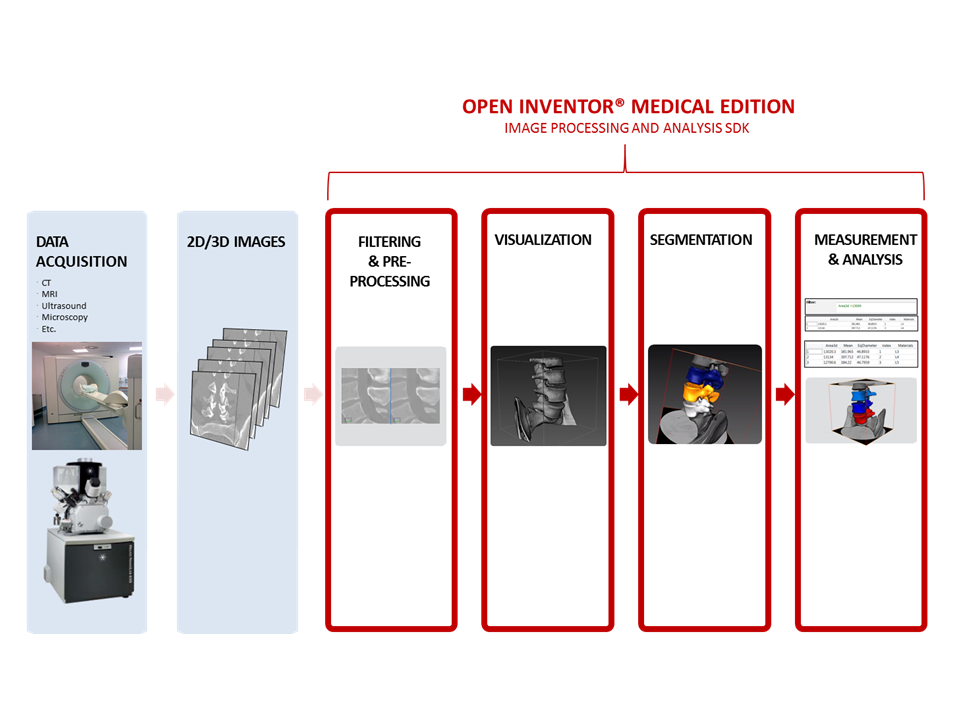 Open Inventor Medical toolkit - Provide advanced image analysis capabilities - Open Inventor Medical Edition