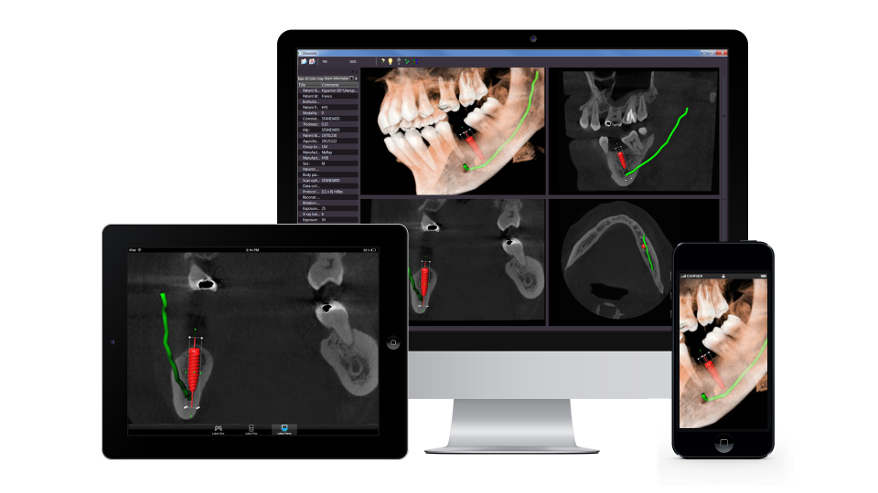 Open Inventor Medical Edition 3D SDK Toolkit - Dental Software
