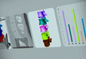 integrate image analysis capabilities into medical software applications, with Open Inventor toolkit