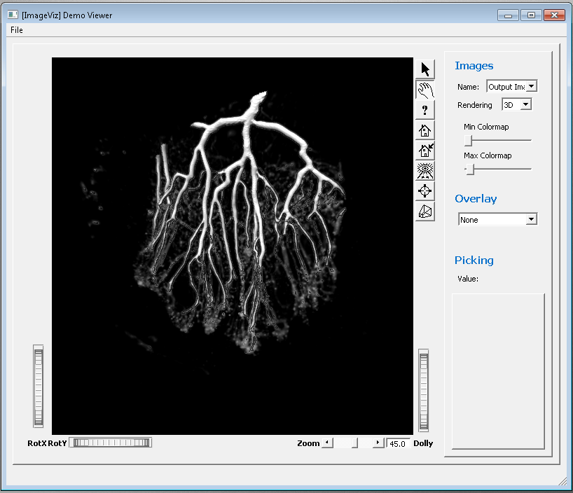 example_vesseldetection3d.png
