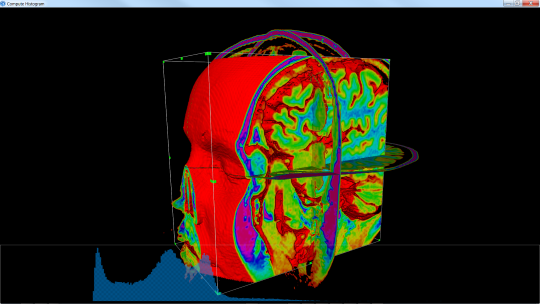 medicalComputeHistogram.png