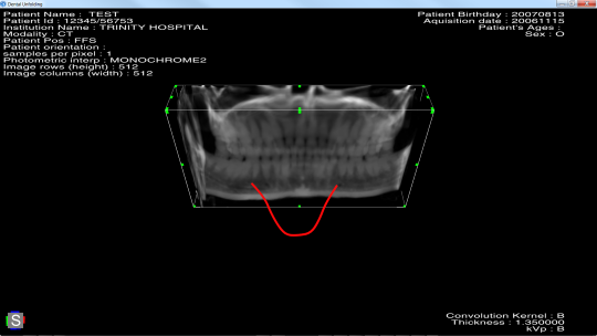 medicalDentalCurveUnfolding.png