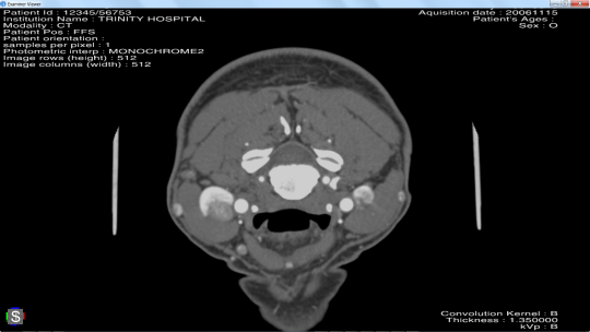 medicalOrthoSlice.png