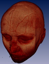 volume_jitter.jpg